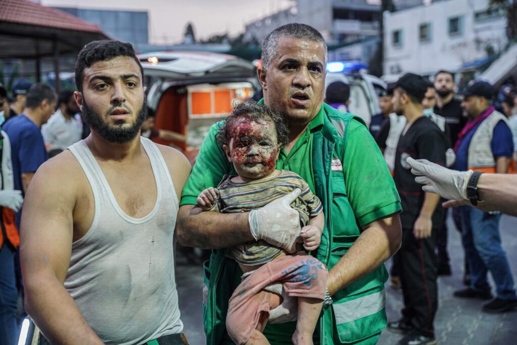 A paramedic holds a little girl with her face full of blood and dirt from the effects of the bombing of Israeli planes.