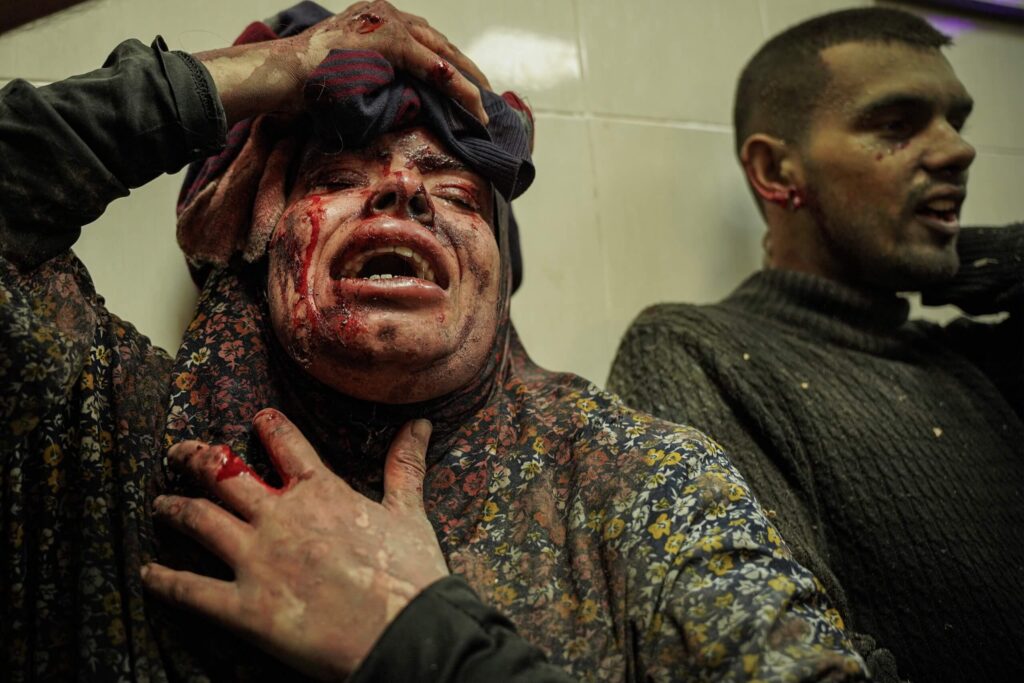 A Palestinian woman cries, her face full of blood, after she was injured and lost her family as a result of the bombing of their house in the city of Khan Yunis, south of the Gaza Strip, by Israeli warplanes.